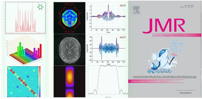 磁共振设备发展史,磁共振成像的发展历程