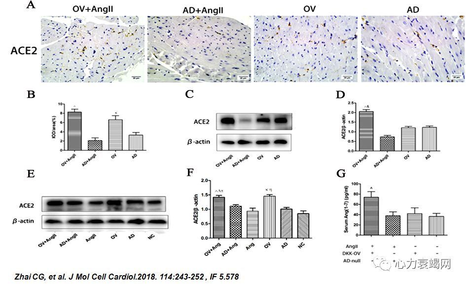 「2019CIHFC」张运教授:ADAM17—糖尿病性心肌病干预的新靶点
