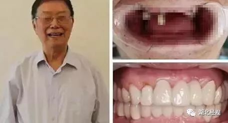 最新武汉垃圾分类消息,武汉垃圾分类怎么样了