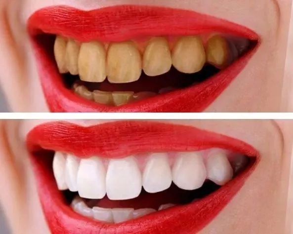 好物丨用它30秒吐掉嘴里所有脏东西,连呼吸都是水果味