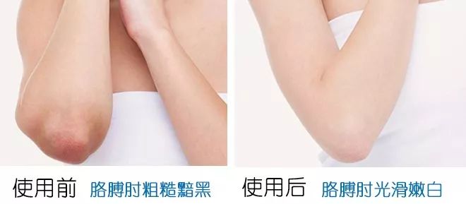 洗澡搓背神器不伤肤无痛,洗澡搓背神器去死皮深层清洁