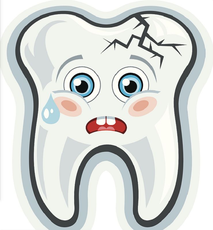 根管治疗后做牙套还要补牙吗,做牙套需要根管治疗吗