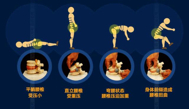 4-5椎间盘膨出严重吗,产后膨出怎么自测