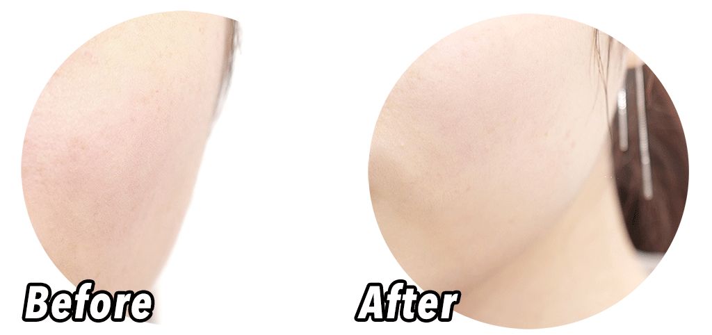 贴片式面膜推荐补水修复,口碑最好的贴片面膜