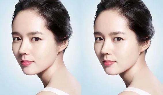 全智贤的痣在哪边,全智贤鼻头的痣好不好