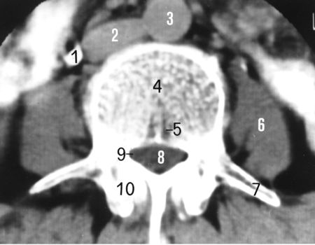 一分钟带你了解腰椎狭窄,椎管狭窄症知识大全