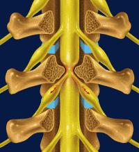 一分钟带你了解腰椎狭窄,椎管狭窄症知识大全