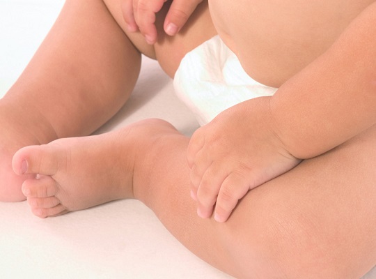 宝宝肚脐出了鼓包,大多不用治