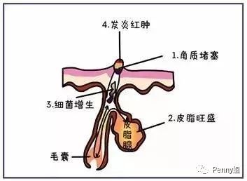 那些年一起挤过的痘痘,那些年我们一起倒过的垃圾