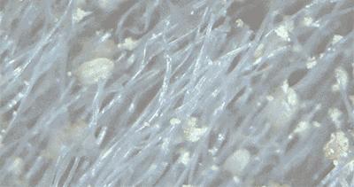 团|墙上插上它，24小时物理除螨，让千万螨虫集体自杀，比太阳暴晒强10000倍