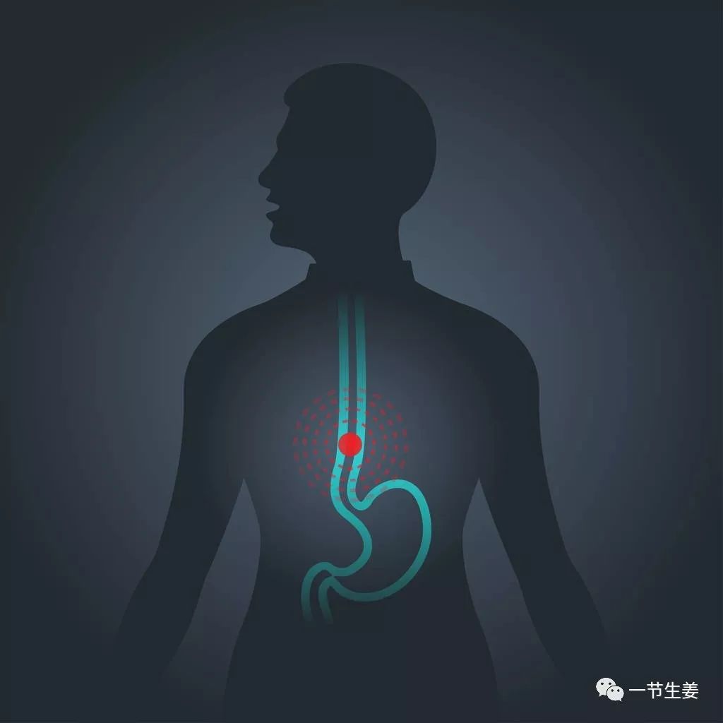 食管癌美国特效药,食道癌治疗的新药