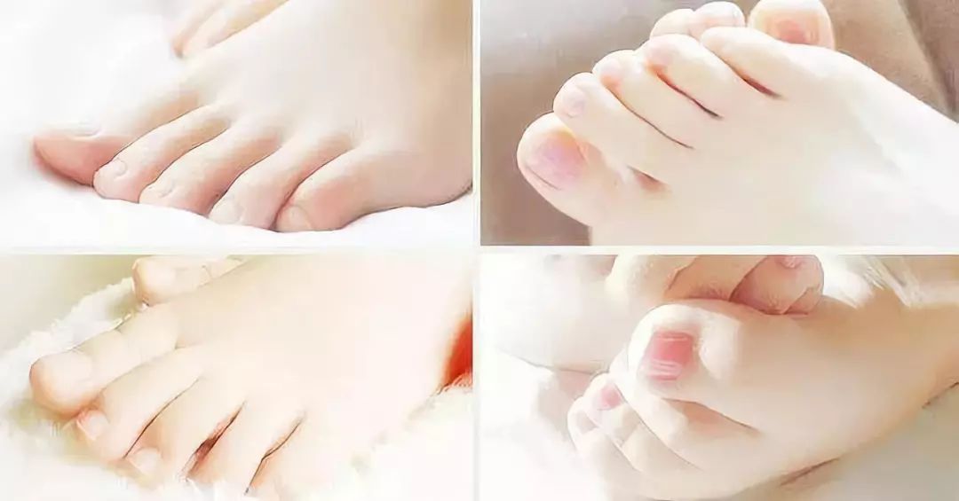 治脚气干裂起皮用什么药膏,有这个方子来治脚气就不怕复发