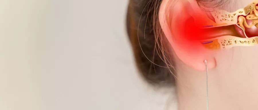 游泳注意事项儿童,去游泳要注意什么