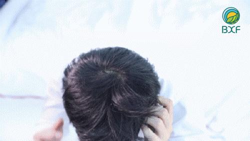 一个月不用洗头快速解决头油头屑,头油头屑多脱发用什么洗