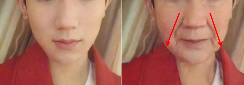 法令纹和眼纹怎么才能有效改善,法令纹贴眼贴有用吗