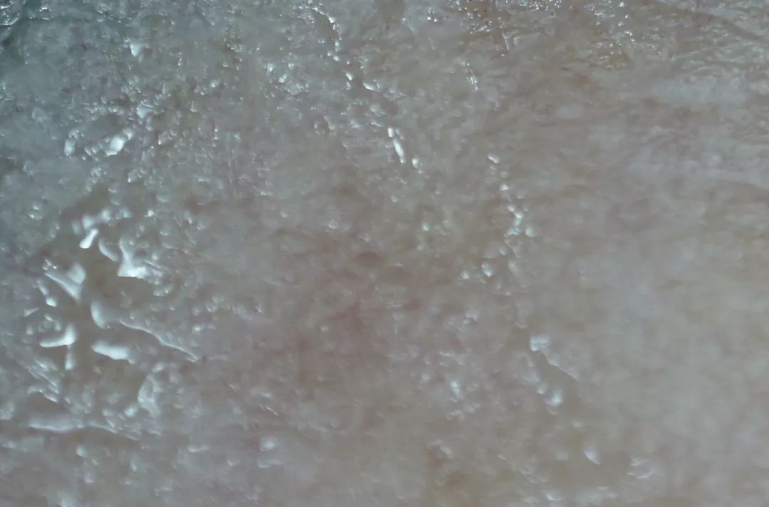 法令纹又黑又长,法令纹又深又长好吗