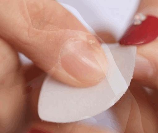 抬头纹眉间纹怎么去除,眉间纹抬头纹去除最好的方法