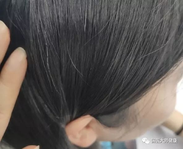 这12种有毒食物你可能天天在吃,别再吃这三种食物毒性太大