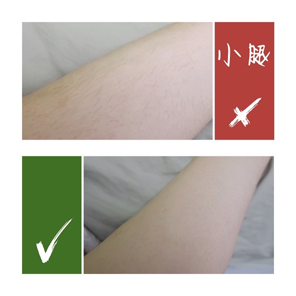 飞利浦脱毛仪详细全过程,猕猴桃家用脱毛仪