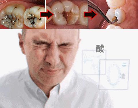 牙龈上火、红肿，还口臭？香港人用了91年的中药牙膏，消炎抑菌，让你刷出一口健康好牙