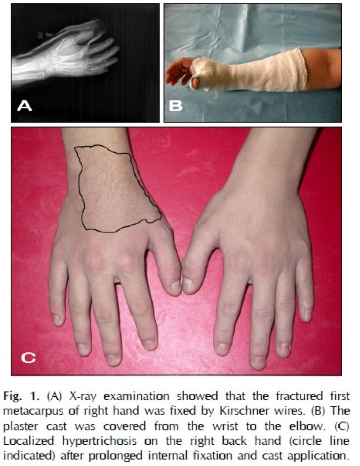 用力搓澡会让皮肤越搓越黑,身体黑搓澡可以搓白吗