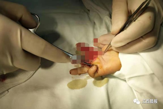 看着都疼受伤瞬间,看着都痛的瞬间小学生