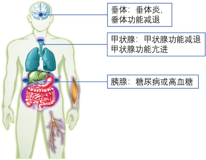 进言献策|免疫检查点*制剂抑**之内分泌不良反应