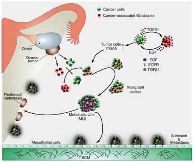 高庆蕾医学专家,高庆蕾卵巢癌生活方案