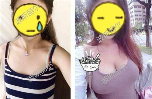 比较靠谱的丰胸产品是什么,推荐真正有效的丰胸产品