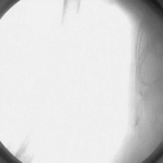 冠脉造影技术成熟不,跟我学技术分析从入门到精通