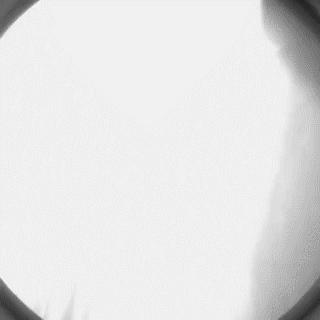 冠脉造影技术成熟不,跟我学技术分析从入门到精通