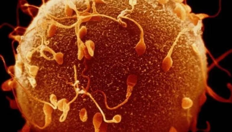 父亲精子正常会不会遗传给儿子,父亲的精子质量会遗传吗