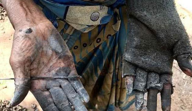 腰果买带皮的还是去皮的,腰果为什么价格差那么多