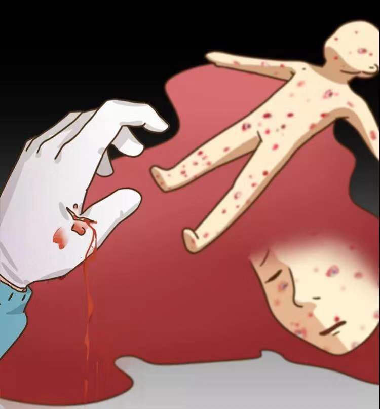 hiv职业暴露的预防措施及处理原则,hiv进入艾滋病期间会有什么反应