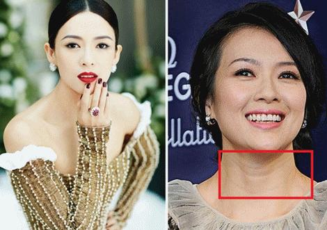 蛋白贴去皱,胶原蛋白颈纹贴