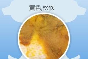 宝宝便便怎么区分好坏,宝宝大便知多少