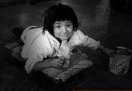 眼球被挖了还会活着吗,眼球被挖了之后眼皮还能睁开吗