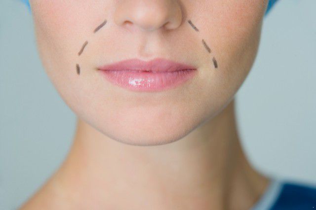 怎么改善法令纹最好的方法,有什么好的方法改善法令纹