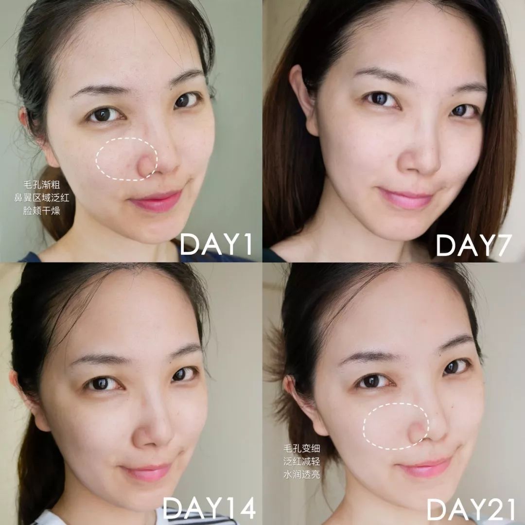 肌诊室·特别版|真人体验，医美素颜光vs明星微精华，改善皮肤哪家强？