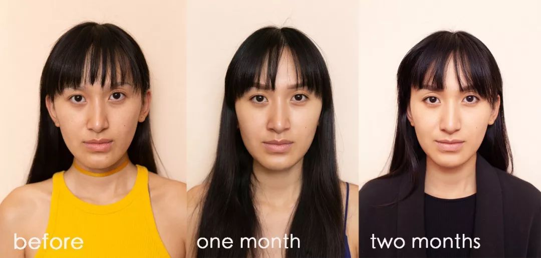 肌诊室修复,肌诊室水光肌挑战