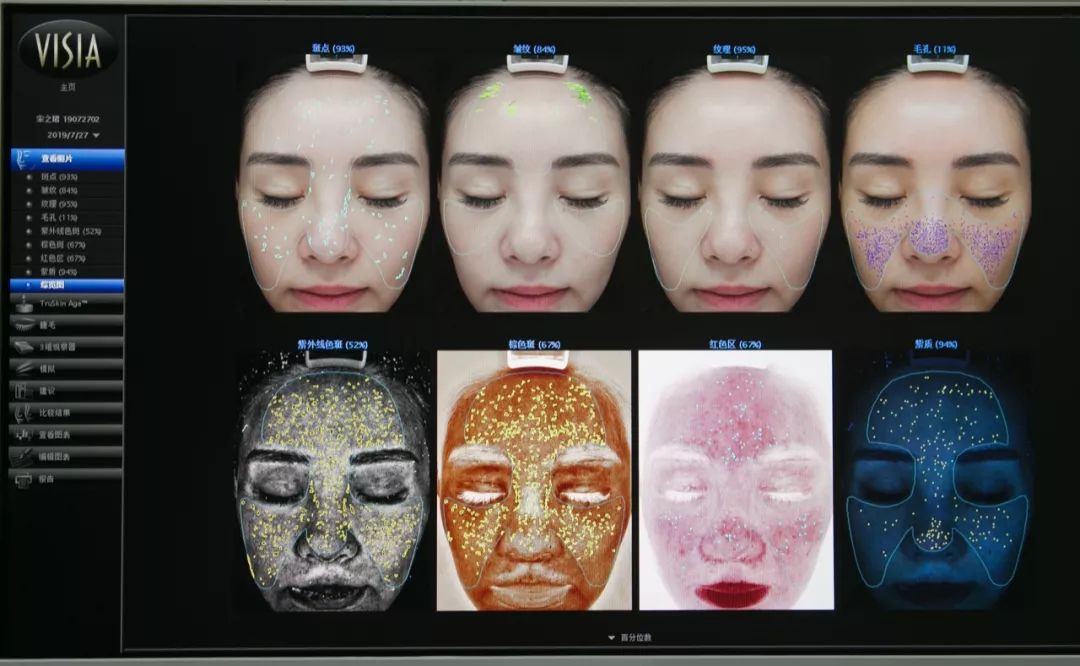 肌诊室修复,肌诊室水光肌挑战