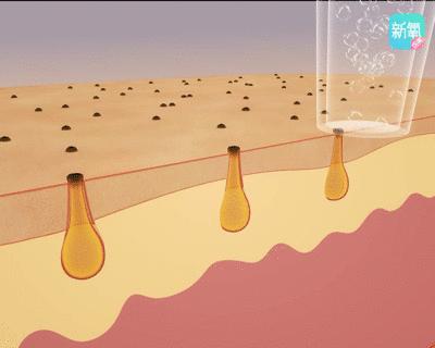 1元体验“爱马仕”级的变美服务，限量100份，再不抢就没了