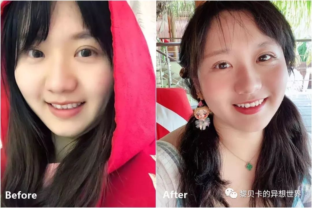 最短只要一年，这件事做对了堪比整容