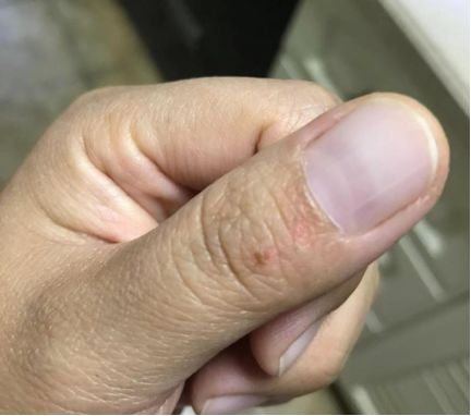 燃气灶玻璃面板炸裂还可以做饭吗,做饭燃气灶玻璃面板烫手正常吗