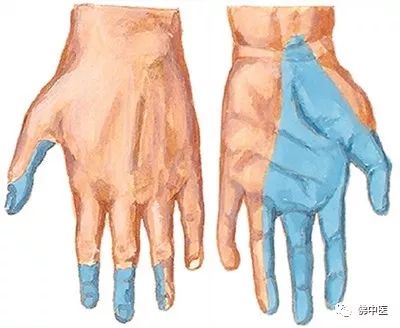 指尖发麻有针刺感看什么科室,左手拇指食指发麻针灸怎么治疗