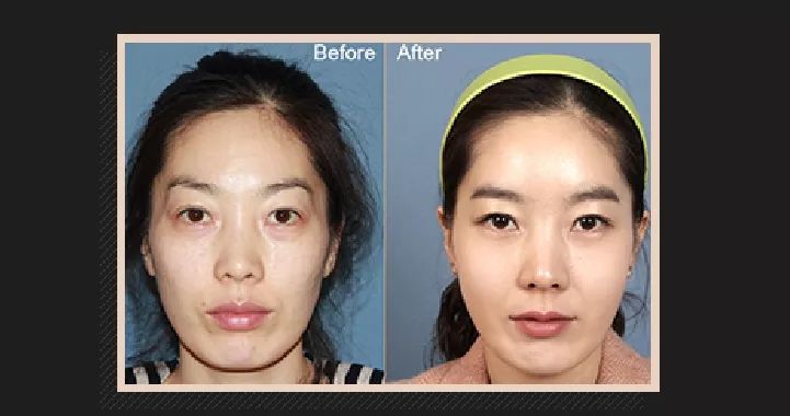 顶级神颜,韩国十大顶级神颜