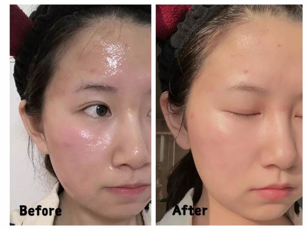 早晨起床对抗懒癌,懒癌晚期护肤的正确方法