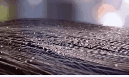 头皮痒头屑多有头螨怎么办,头螨大块头屑怎么治好得快