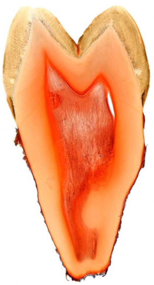 关爱口腔预防龋齿,爱牙科普小实验