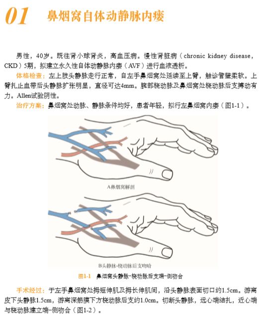 血液透析全套书,血液透析血管通路书籍推荐